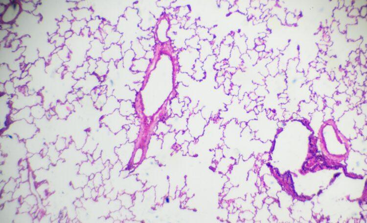 Biopsia liquida