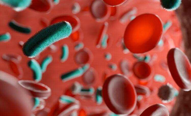Sepsi biomarcatore