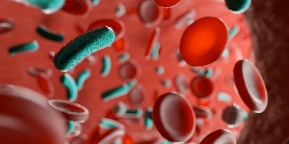 Sepsi biomarcatore
